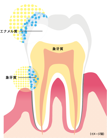虫歯予防イメージエナメル質　象牙質